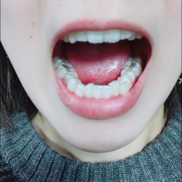 pic20180301205037_2.jpg