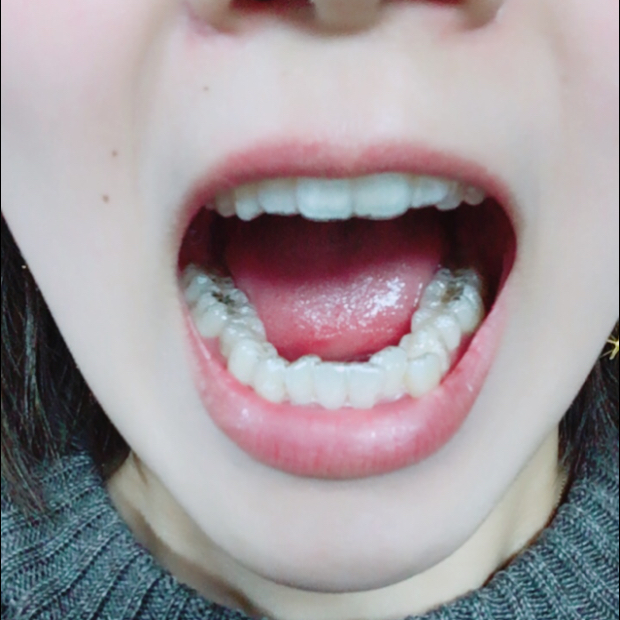 pic20180404234258_3.jpg